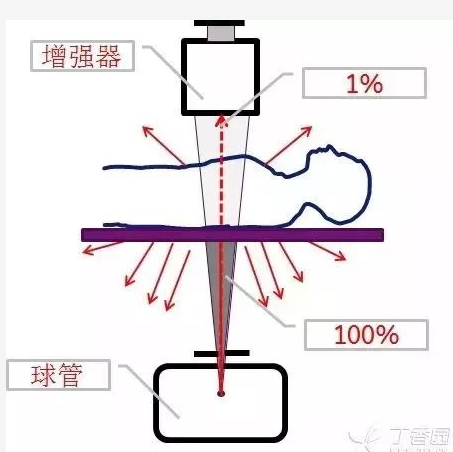 请重视手术室里X射线对医生的伤害