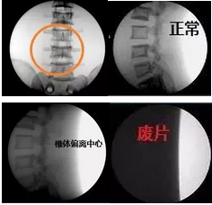 请重视手术室里X射线对医生的伤害