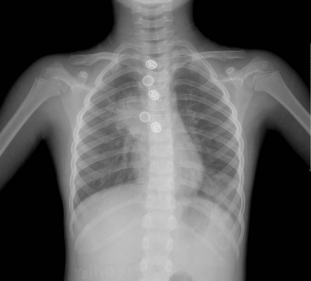 关于辐射，看完本文章你会有新的认识